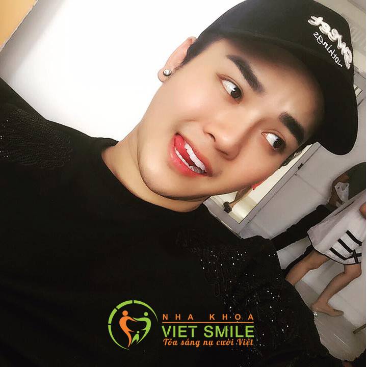 Niềng Răng Hà Nội