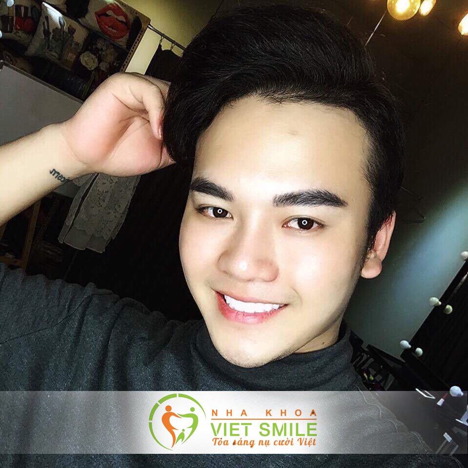 Niềng Răng Hà Nội
