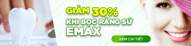 Niềng Răng Hà Nội