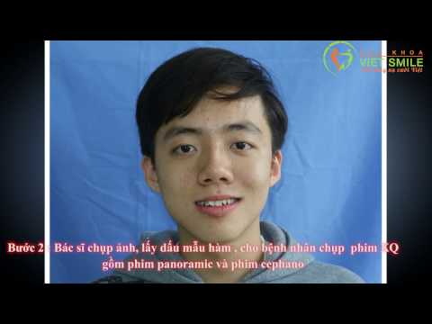 Niềng Răng Hà Nội