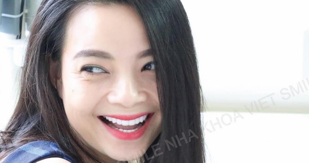 Niềng Răng Hà Nội