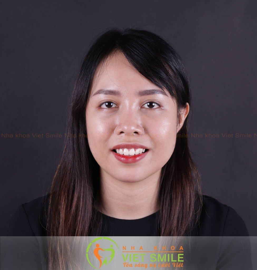 Niềng Răng Hà Nội