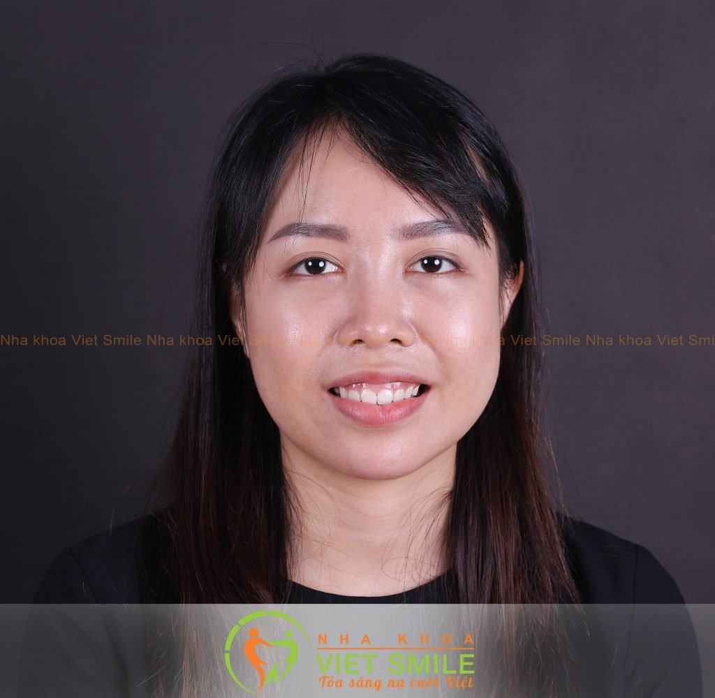 Niềng Răng Hà Nội