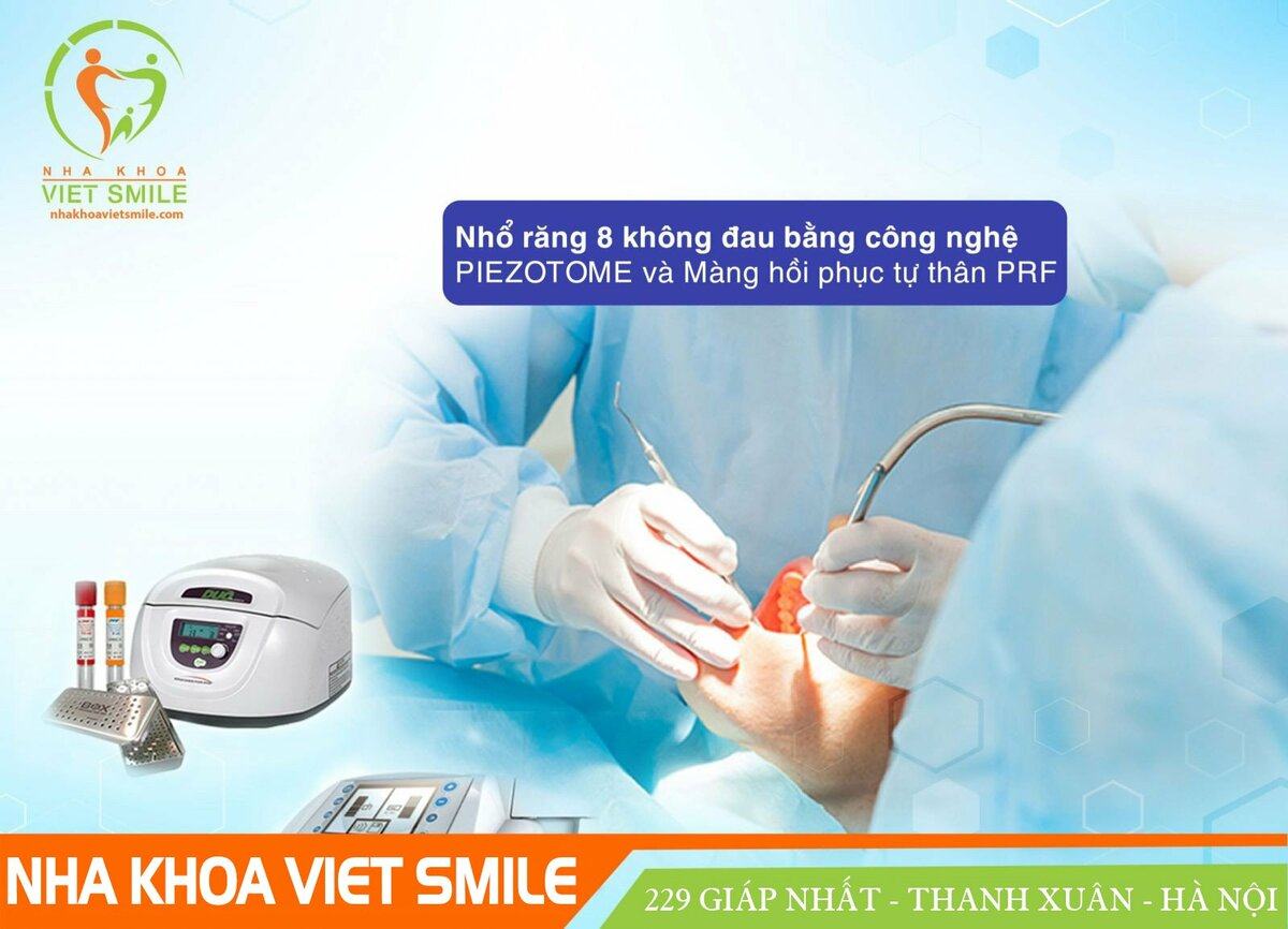 nhổ răng khôn hàm dưới bao nhiêu tiền? đau bao lâu? 3 Nho rang khon