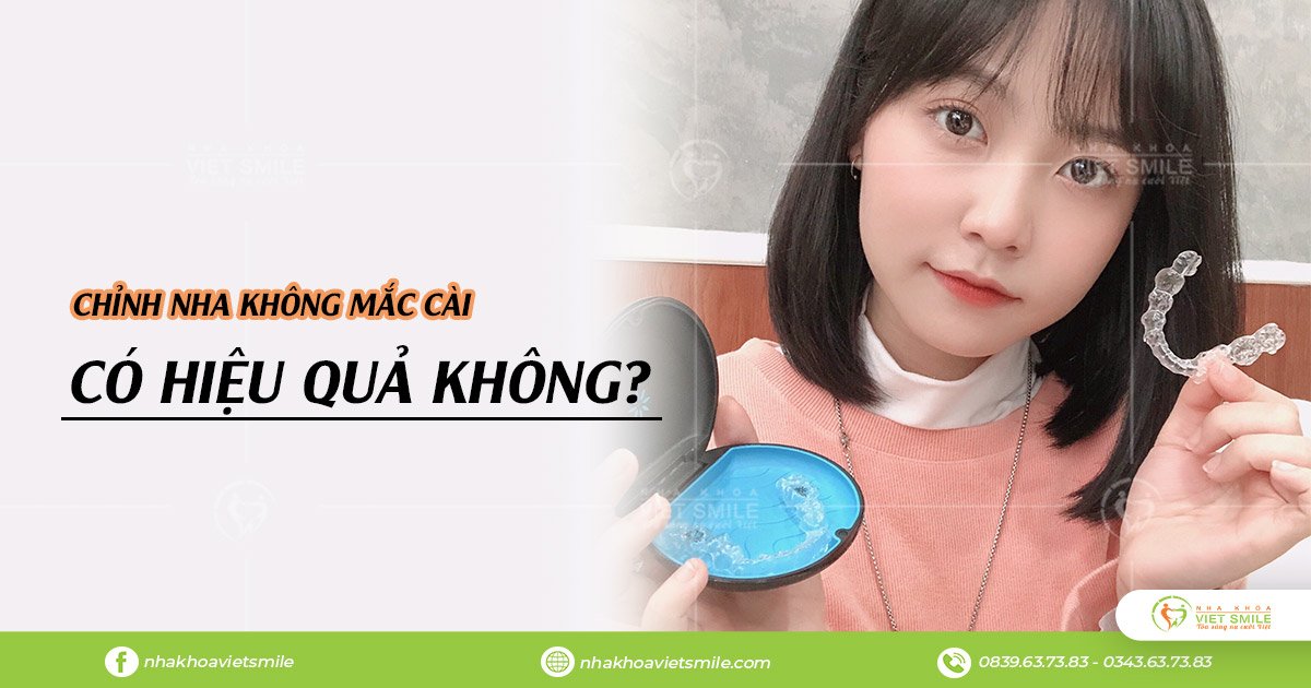 niềng răng invisalign là gì? cần ăn uống, chăm sóc ra sao? 4 Chỉnh nha không mắc cài