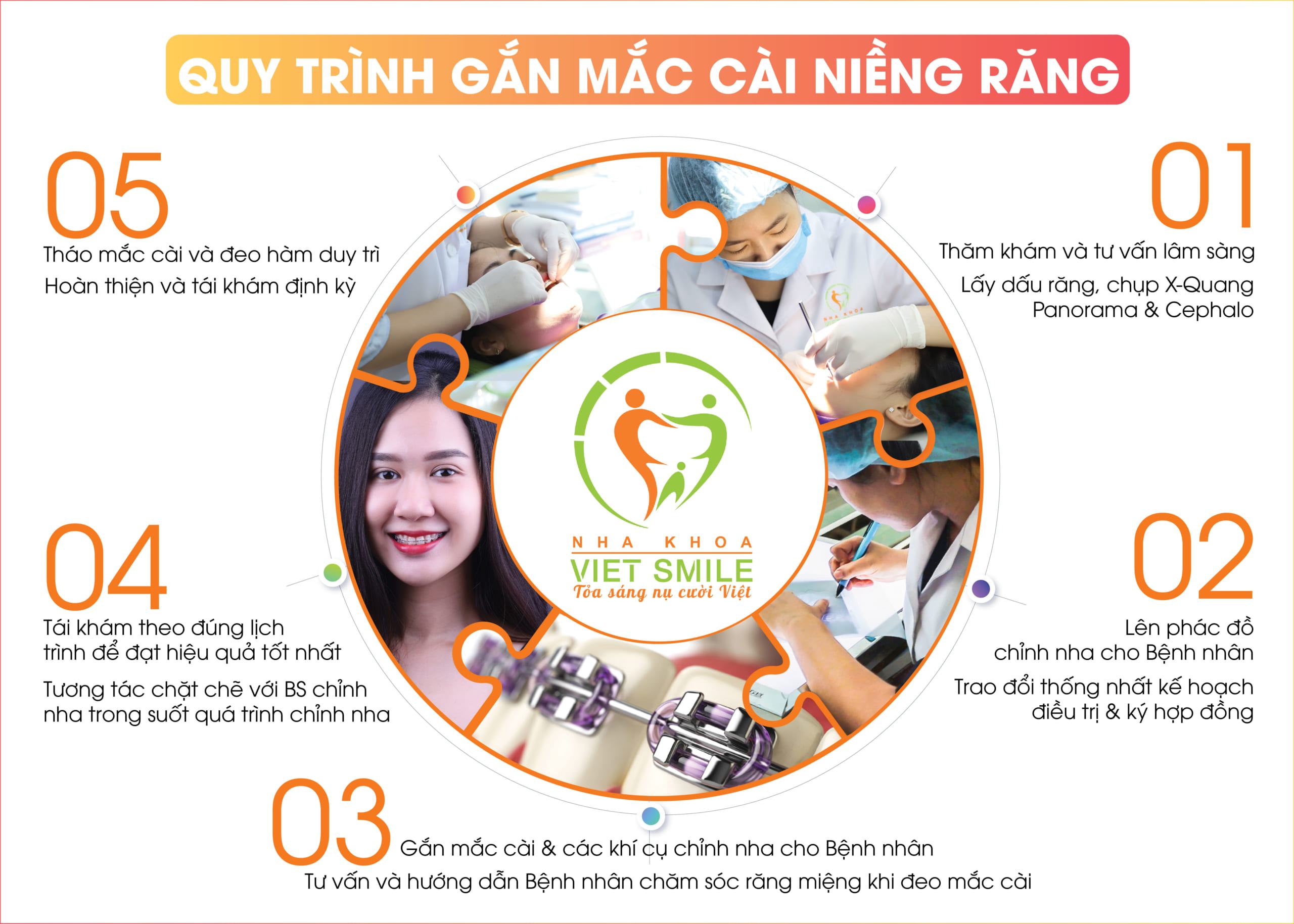 Quy trình niềng răng tại Nha khoa Việt Smile