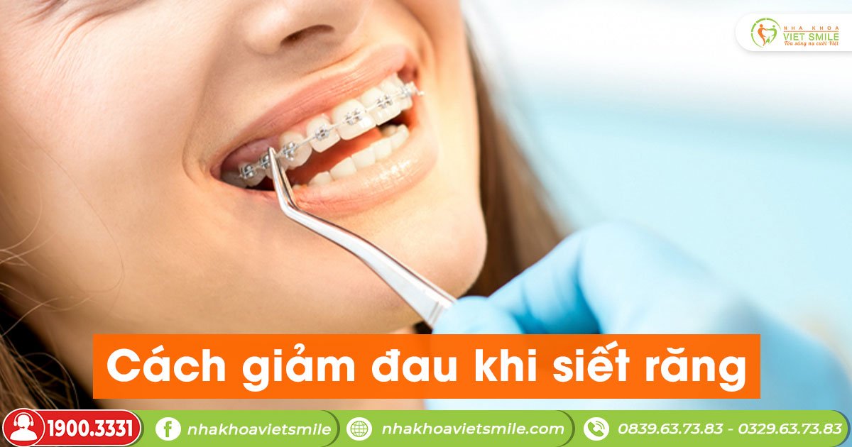 Cách giảm đau khi siết răng