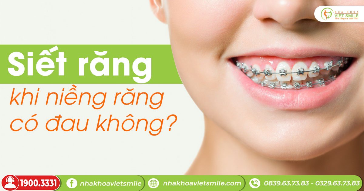 Siết răng khi niềng răng có đau không?