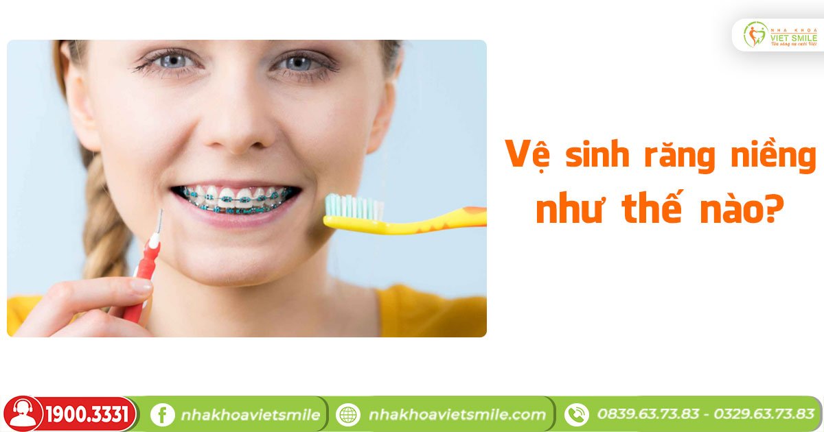 cách vệ sinh răng miệng khi niềng răng