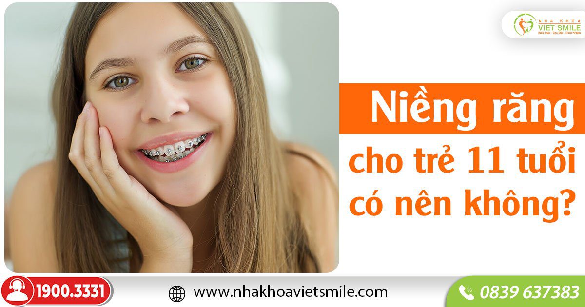 Niềng răng cho trẻ 11 tuổi có nên không?