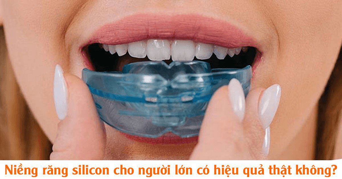 Niềng răng silicon cho người lớn có hiệu quả thật không?