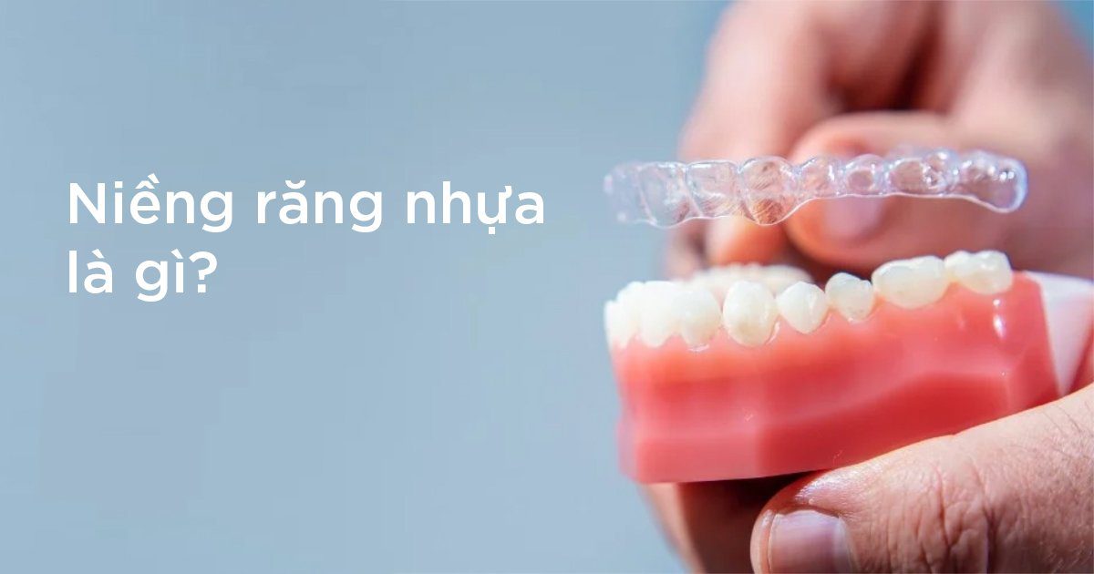 Niềng răng nhựa là gì?