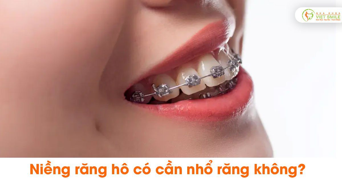 Vietsmile z5403801718716 46da2568991fe11454184fe3233d034e