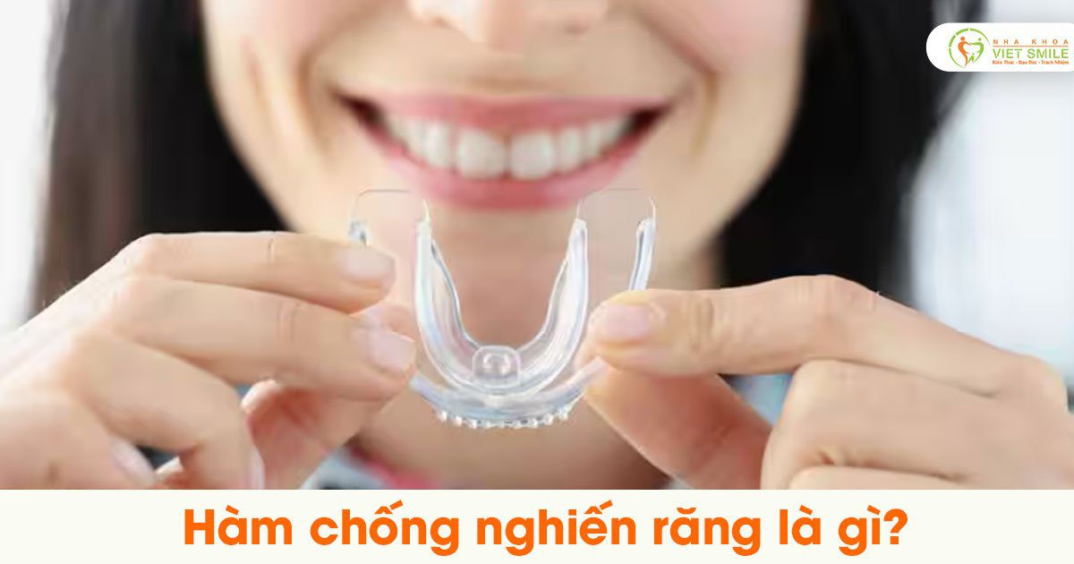 Hàm chống nghiến răng là gì?