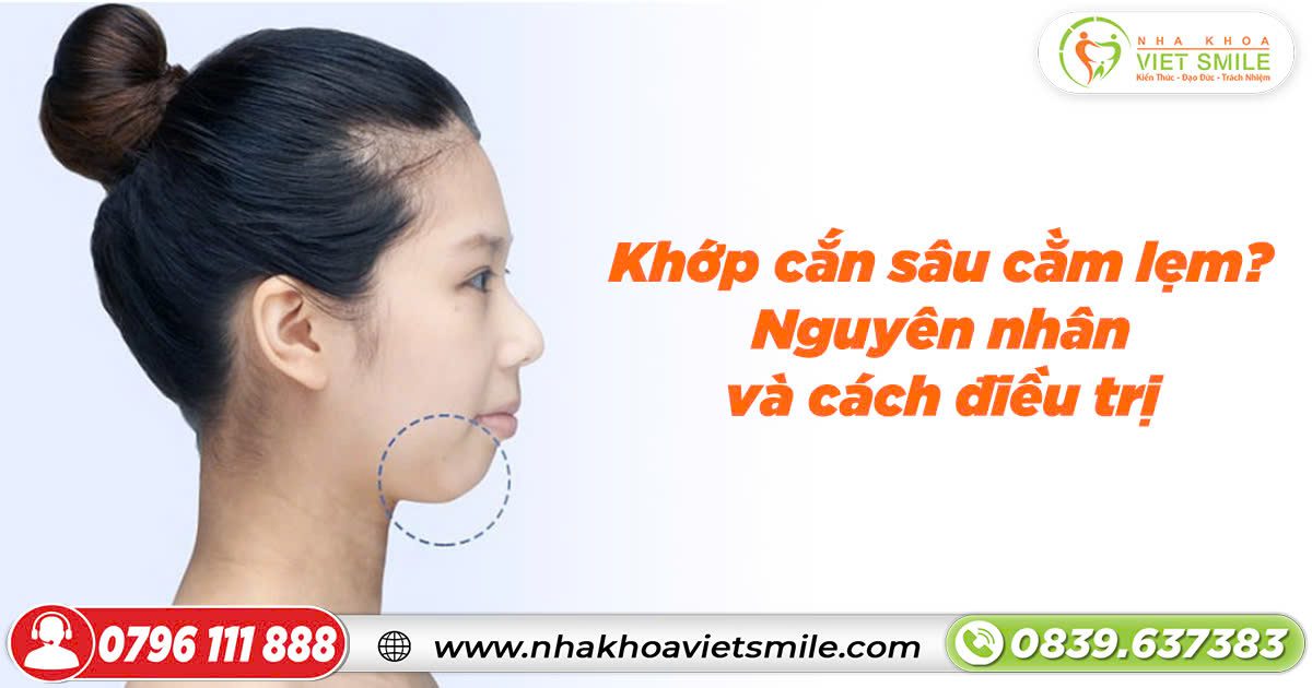 Khớp cắn sâu cằm lẹm? Nguyên nhân và cách điều trị