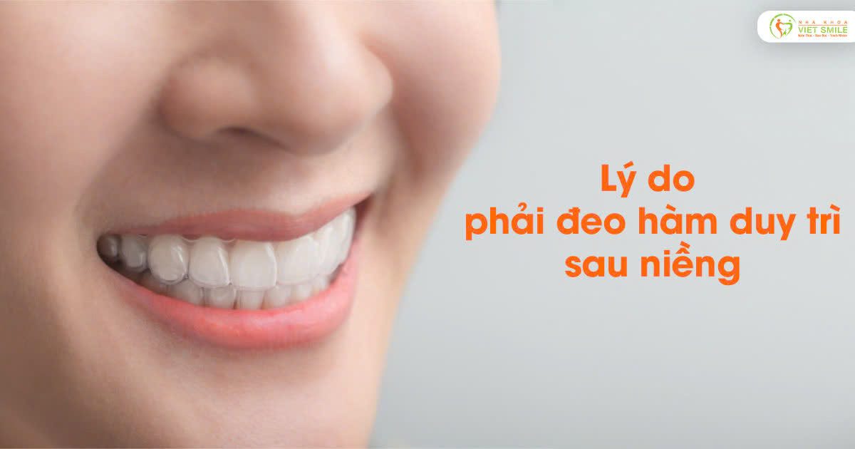 Vietsmile ly do phai deo ham duy tri sau nieng