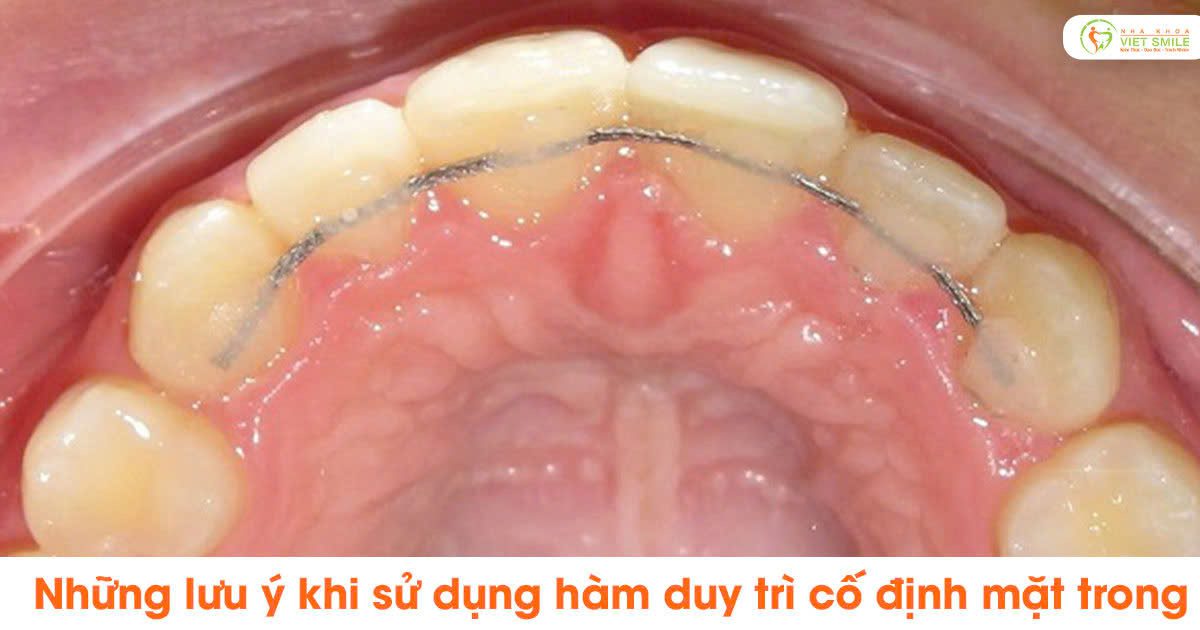 Những lưu ý khi sử dụng hàm duy trì cố định mặt trong