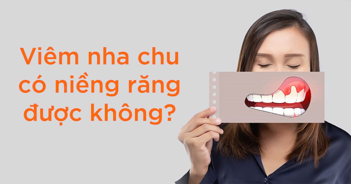 Vietsmile viem nha chu co nieng rang duoc khong