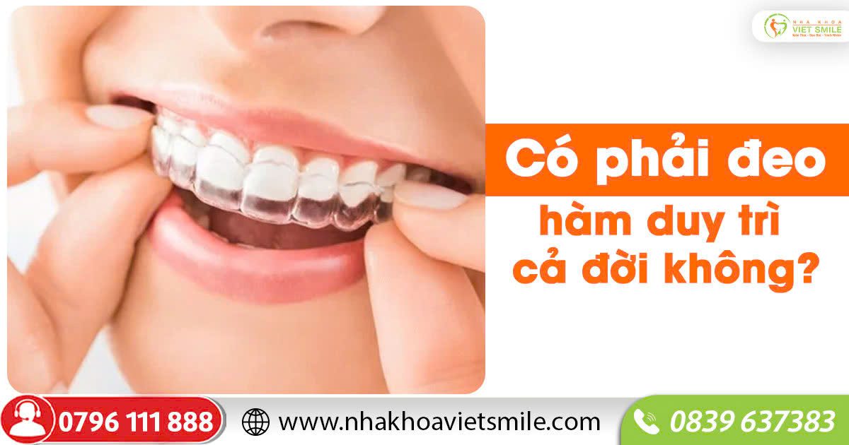 Có phải đeo hàm duy trì cả đời không?