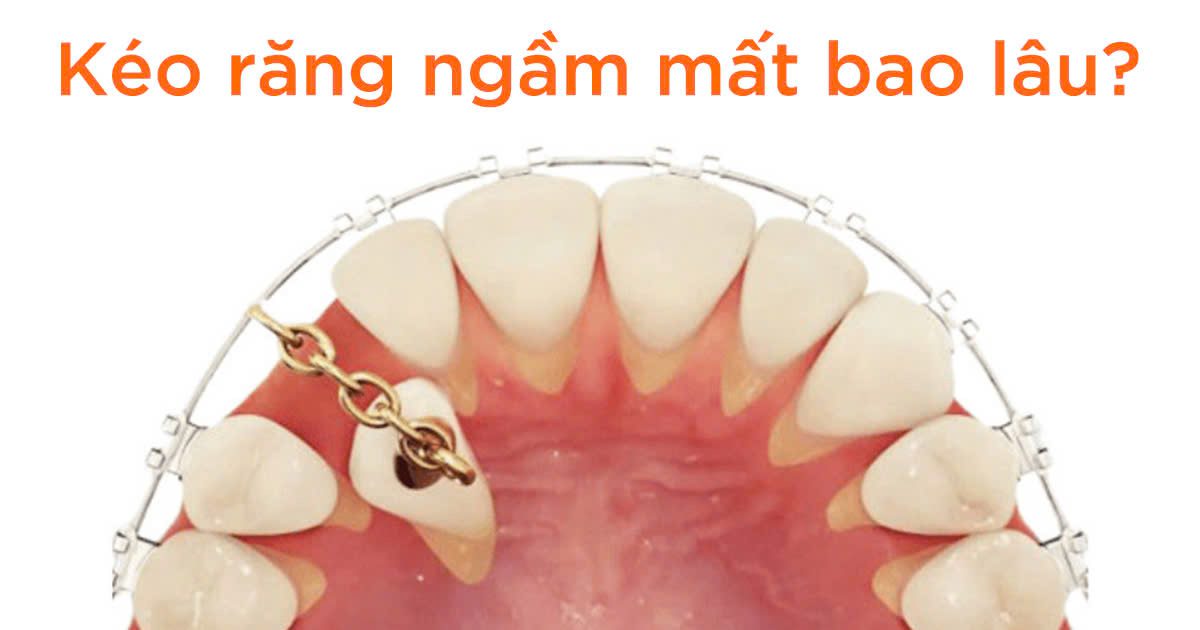 Vietsmile keo rang ngam mat bao lau