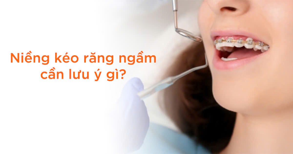 Vietsmile nieng keo rang ngam can luu y nhung gi