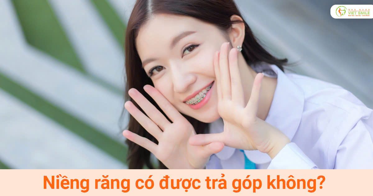 Niềng răng có được trả góp không?