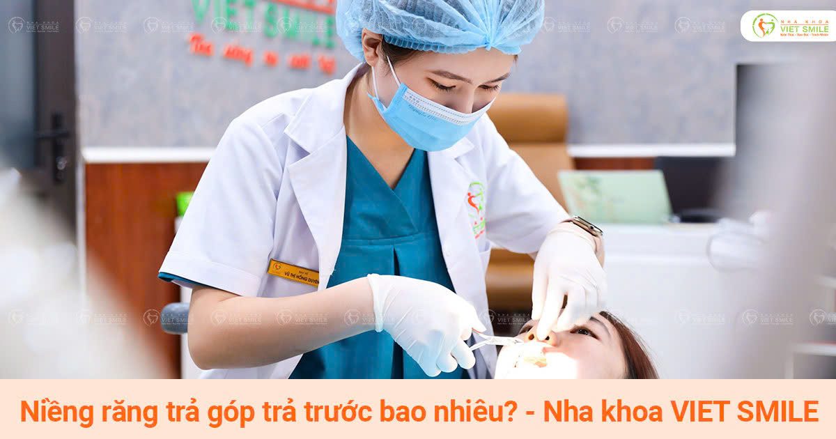 Niềng răng trả góp trả trước bao nhiêu? - nha khoa viet smile