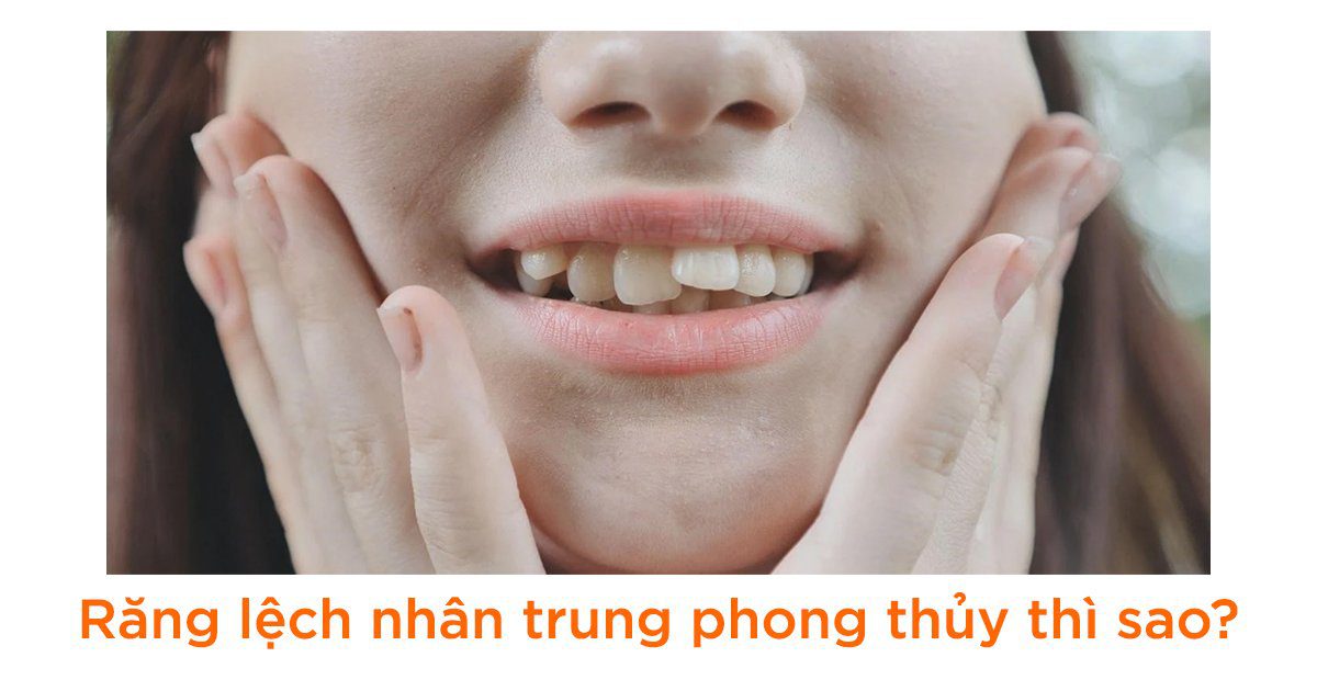 Răng lệch nhân trung phong thủy thì sao?