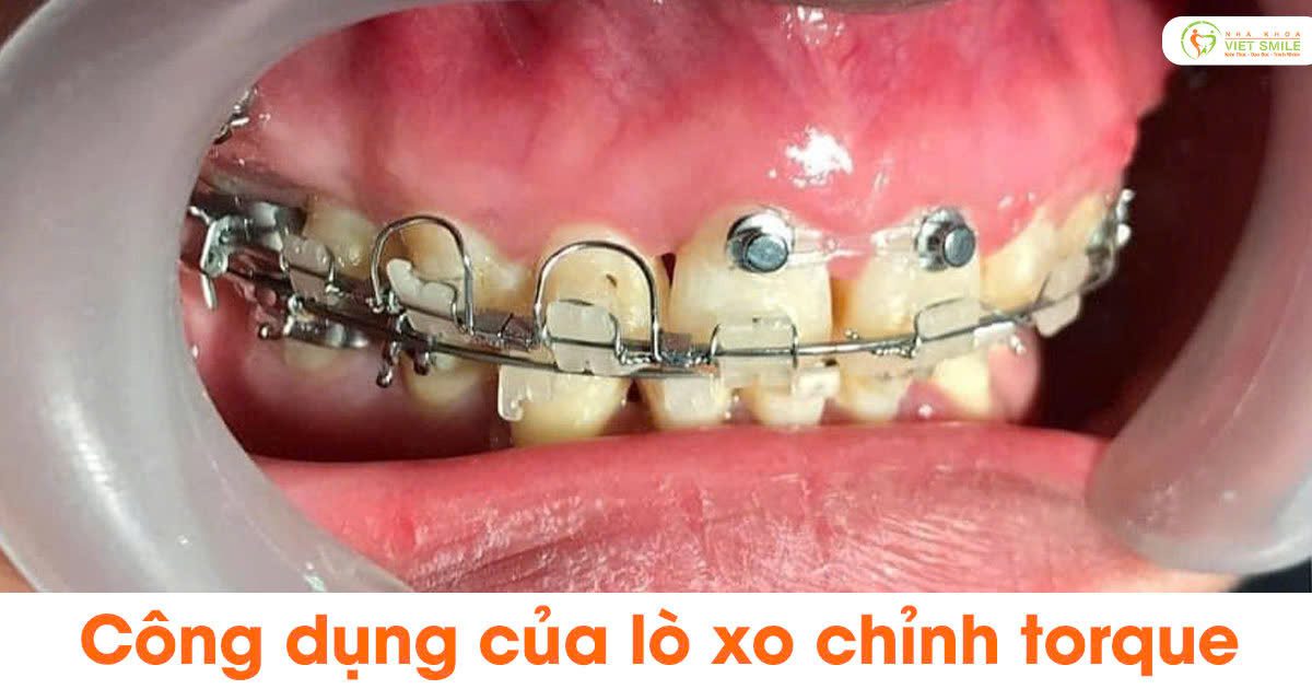 Vietsmile cong dung cua lo go chinh torque