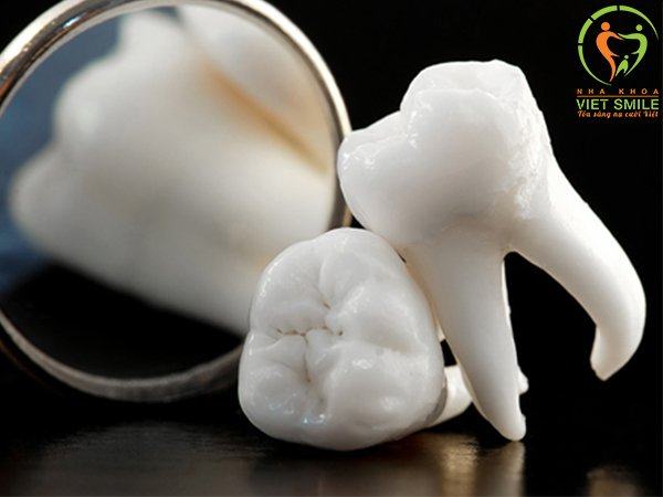 nhổ răng khôn không đau với piezotome và hồi phục nhanh cùng màng prf 2 Nho rang so 8 viet smile
