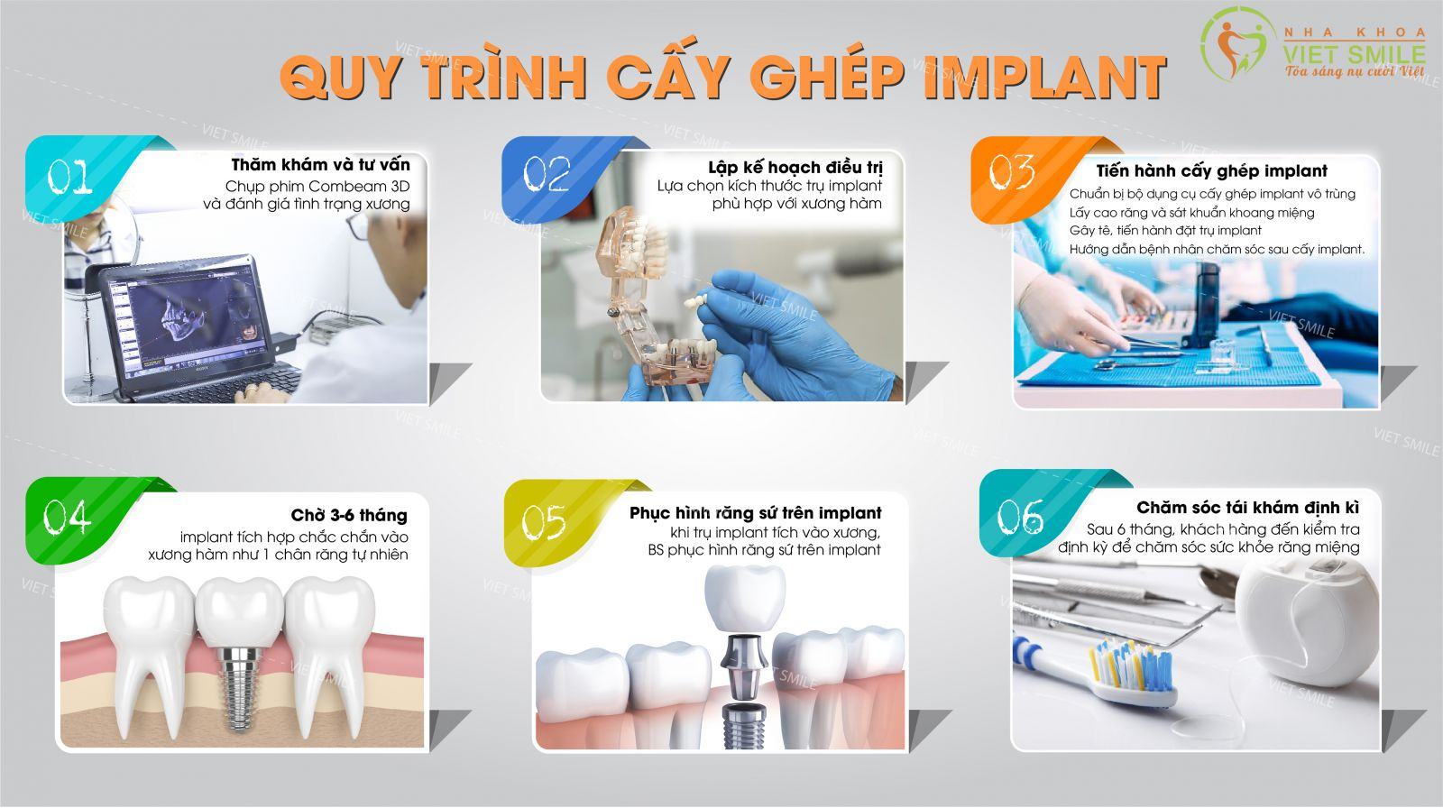 Quy trình cấy ghép implant theo tiêu chuẩn quốc tế được áp dụng tại nha khoa việt smile